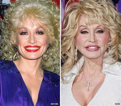 dolly parton natural breasts|Dolly Parton Explains Which Cosmetic Procedures。